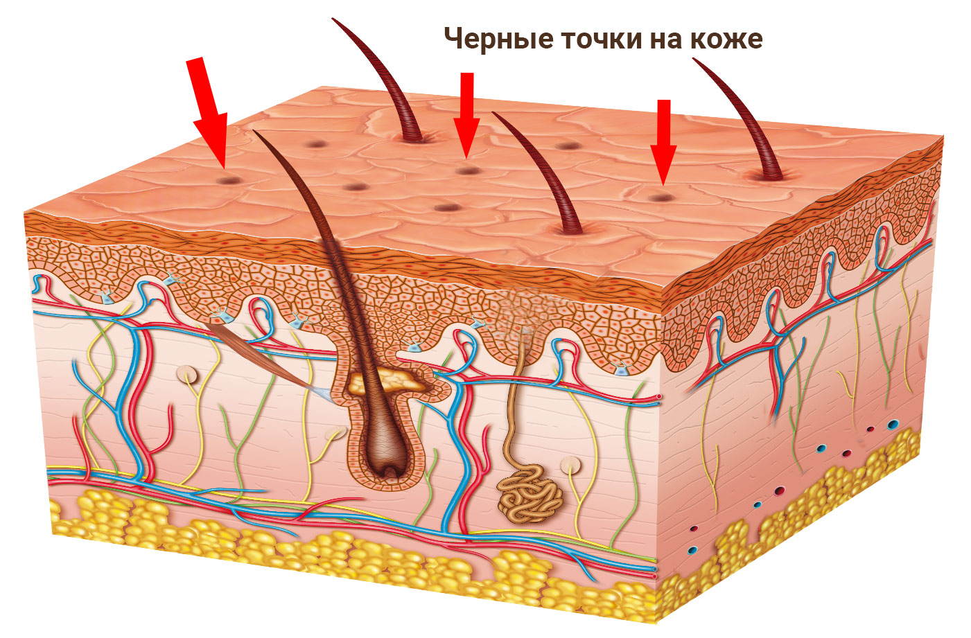 Черные точки на коже