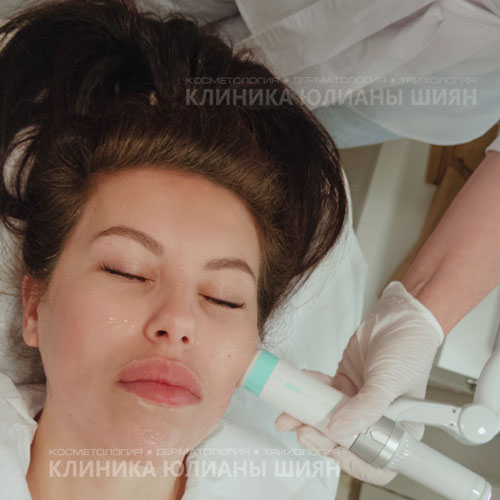 Обработка щеки на процедуре SMAS-лифтинг в кабинете косметологической клиники