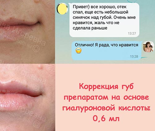 Отзывы из соцсетей о работе врача-косметолога
