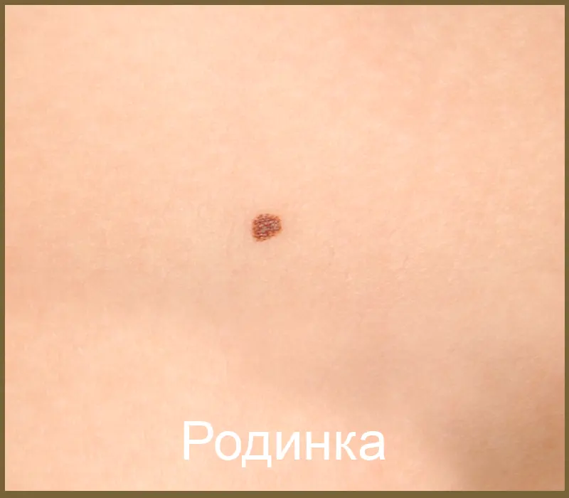 Родинка