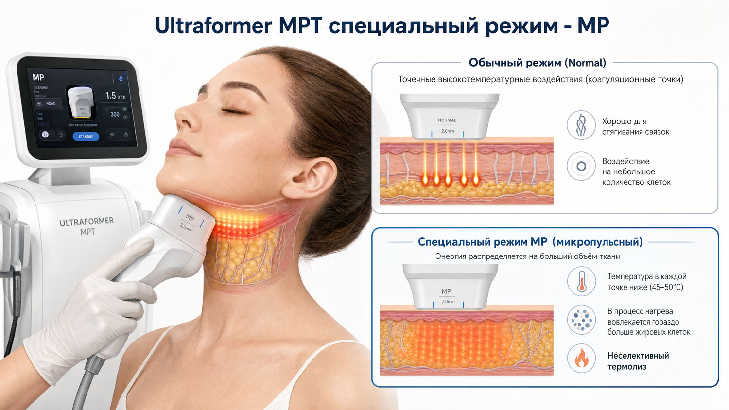 Для процедуры уменьшения второго подбородка включается режим MP (микроимпульсный)